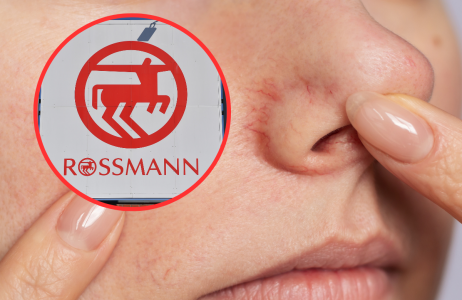 Rossmann