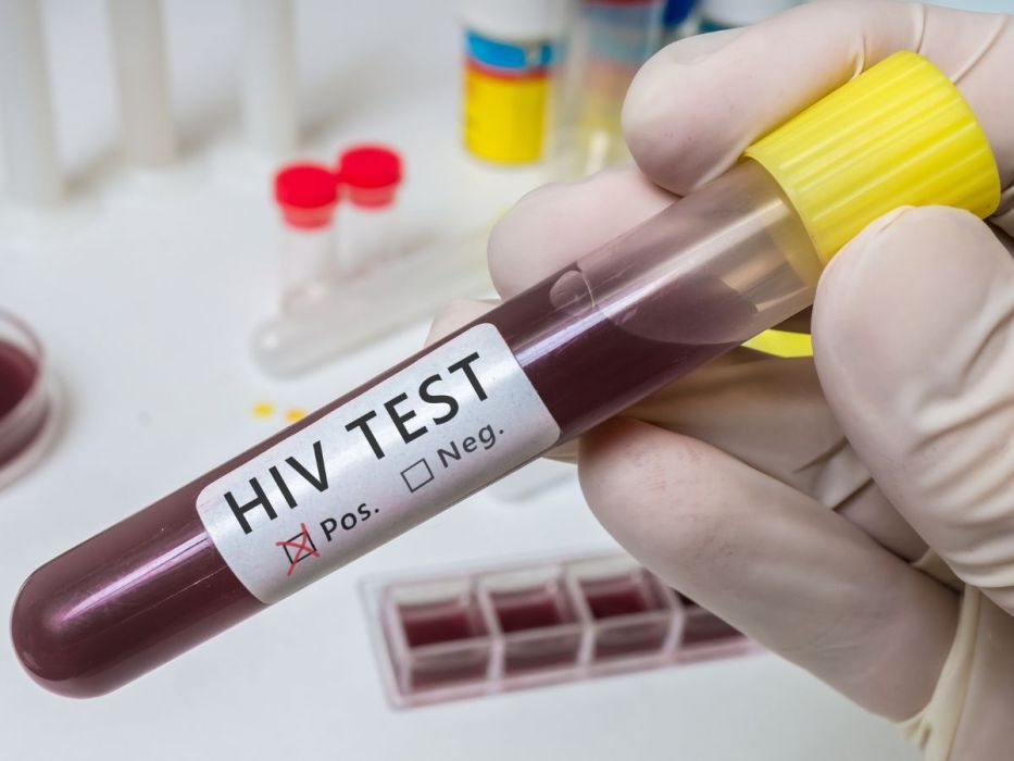 wzrost zachorowań na HIV
