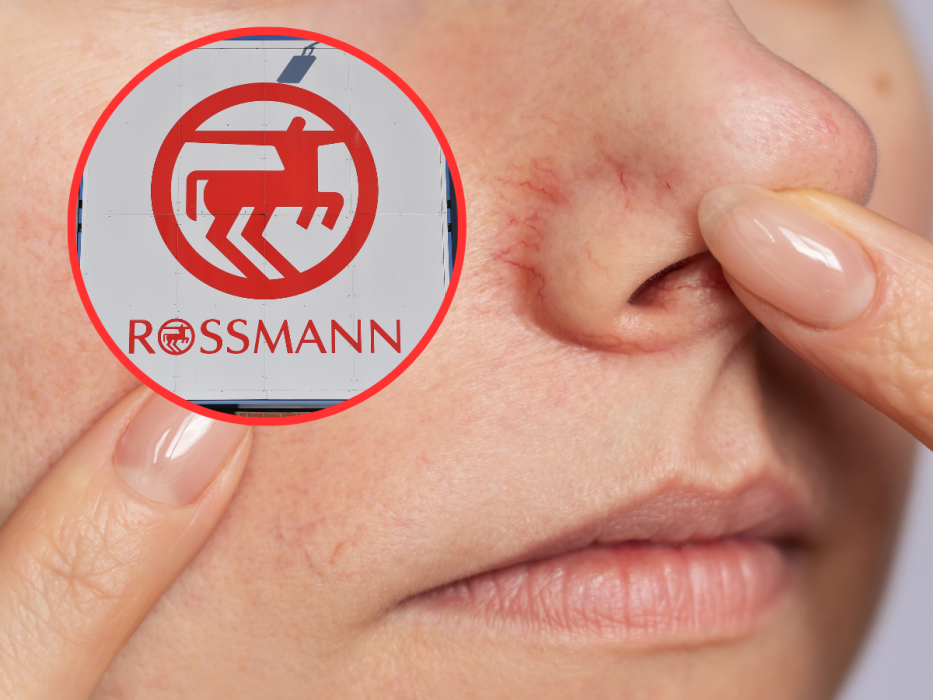 Rossmann